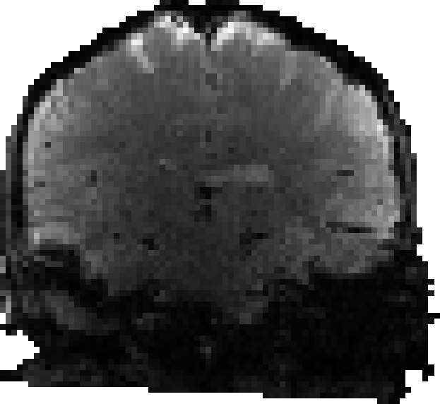 Axial slice of a BOLD image